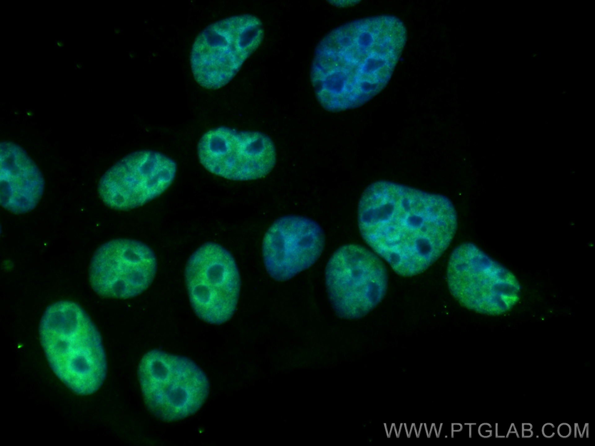 IF Staining of A431 using CL488-67171