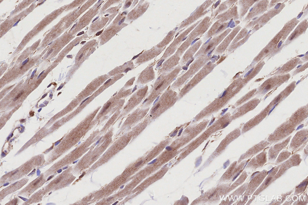 IHC staining of rat heart using 10851-1-AP IHC staining of rat heart using 10851-1-AP