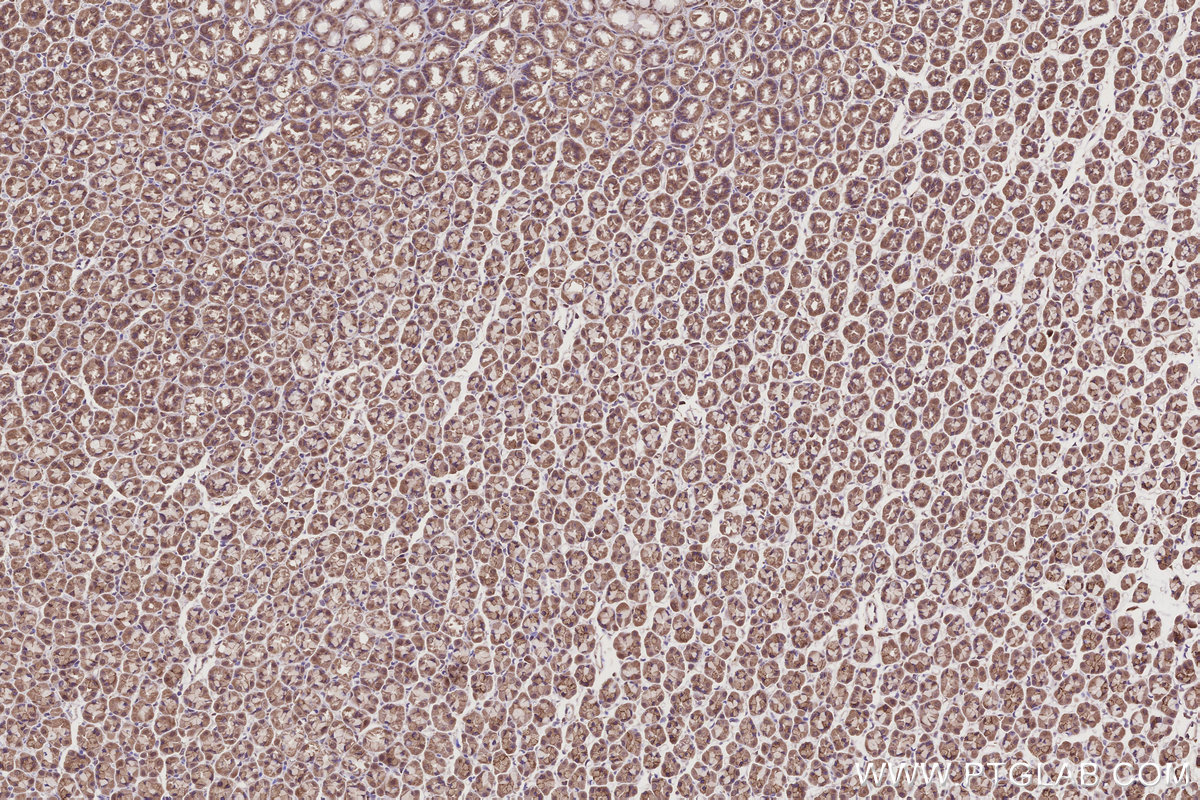 IHC staining of rat stomach using 10851-1-AP IHC staining of rat stomach using 10851-1-AP