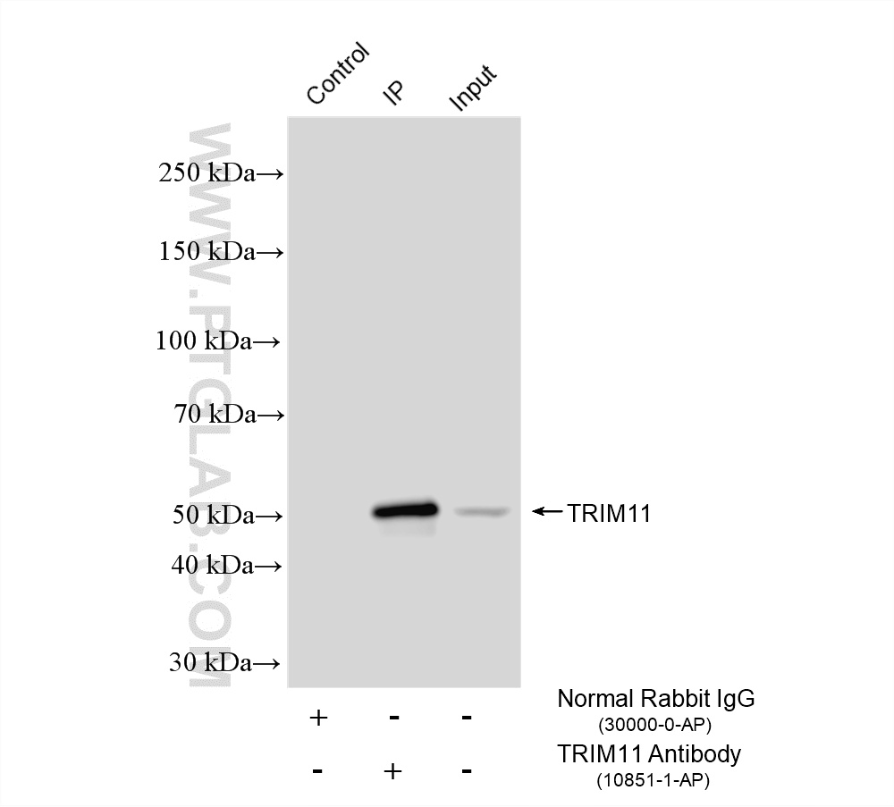 IP experiment of HeLa using 10851-1-AP