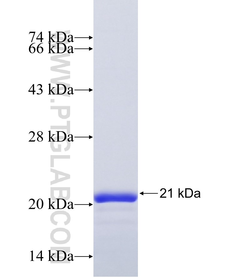 TRIM11 fusion protein Ag41944 SDS-PAGE