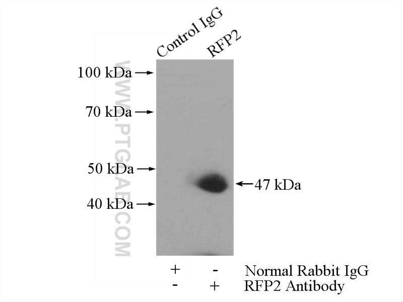 IP experiment of Jurkat using 22021-1-AP