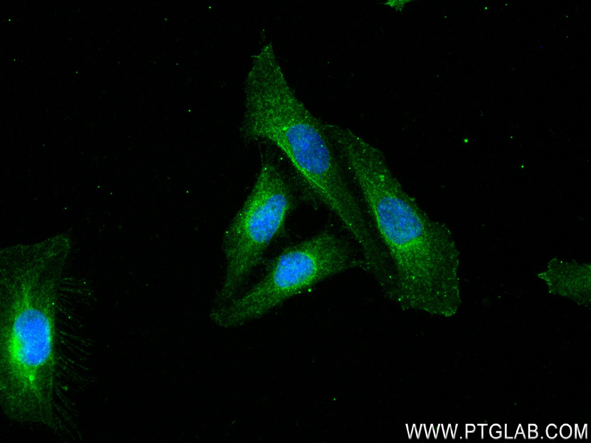 IF Staining of HeLa using 83582-5-RR