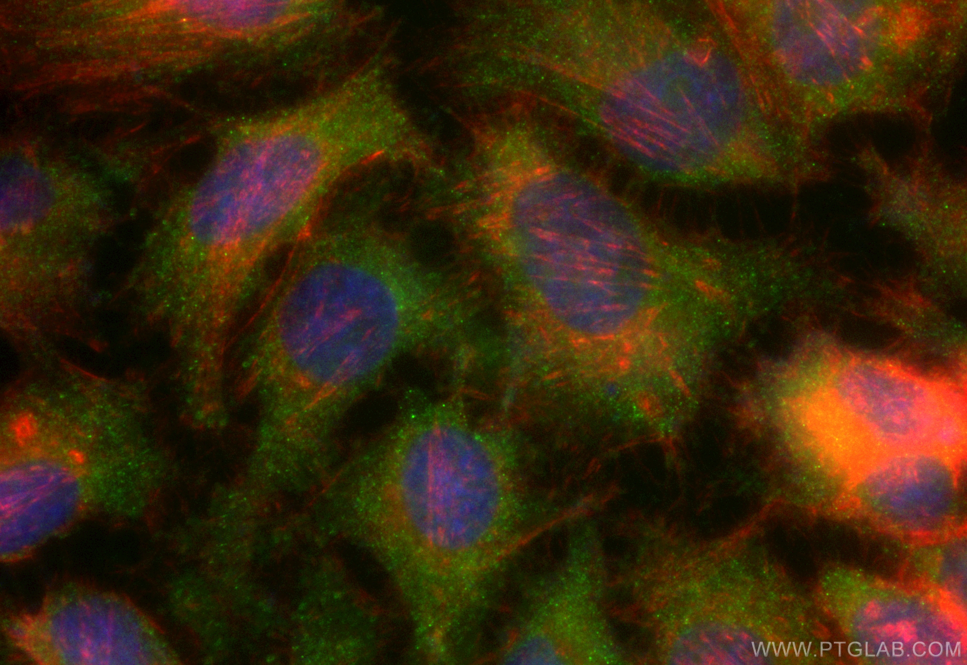 IF Staining of HeLa using CL488-83582-5