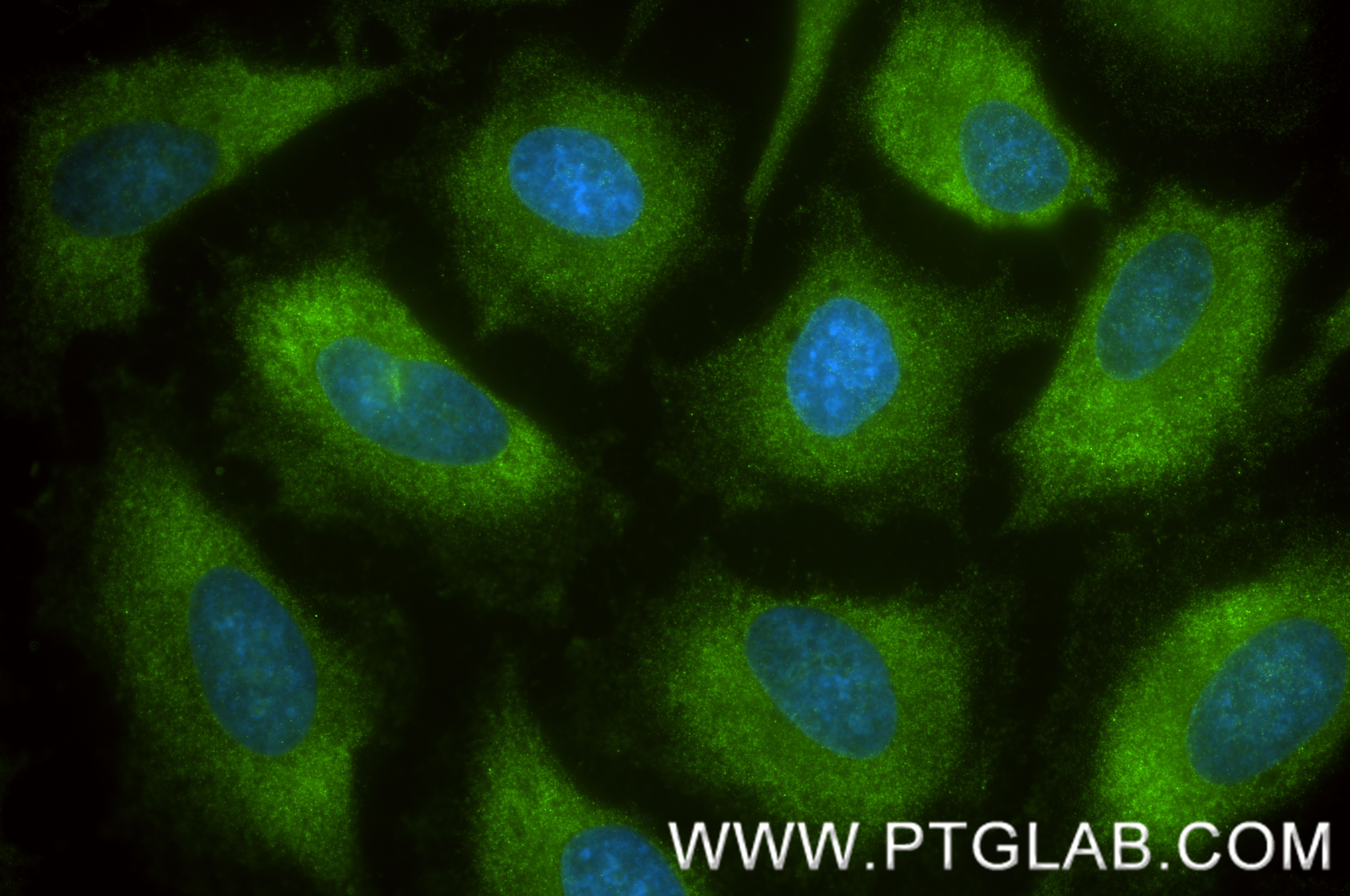 IF Staining of HeLa using 87377-3-RR (same clone as 87377-3-PBS) IF Staining of HeLa using 87377-3-RR (same clone as 87377-3-PBS)