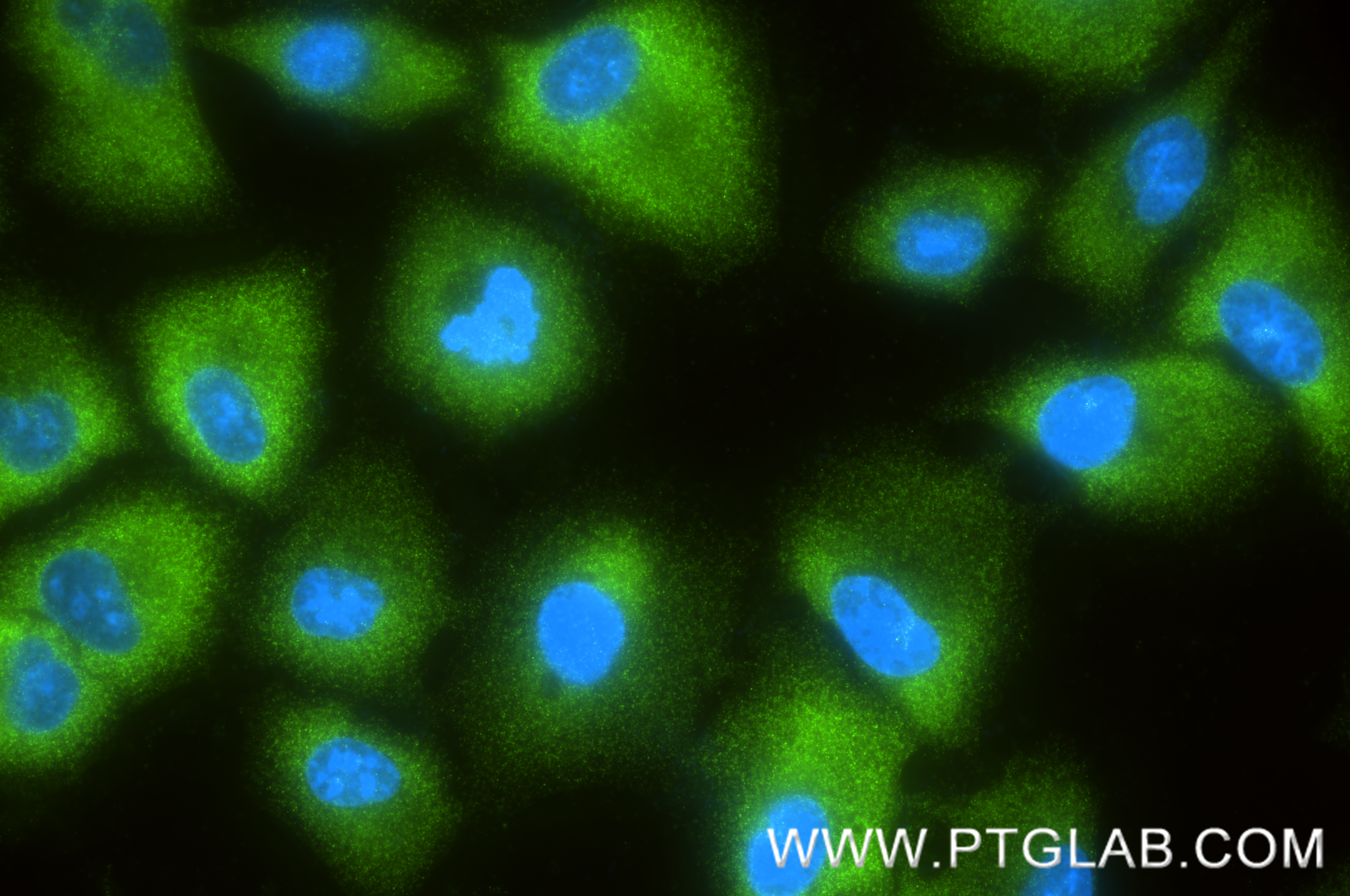 IF Staining of A549 using 87377-3-RR (same clone as 87377-3-PBS) IF Staining of A549 using 87377-3-RR (same clone as 87377-3-PBS)