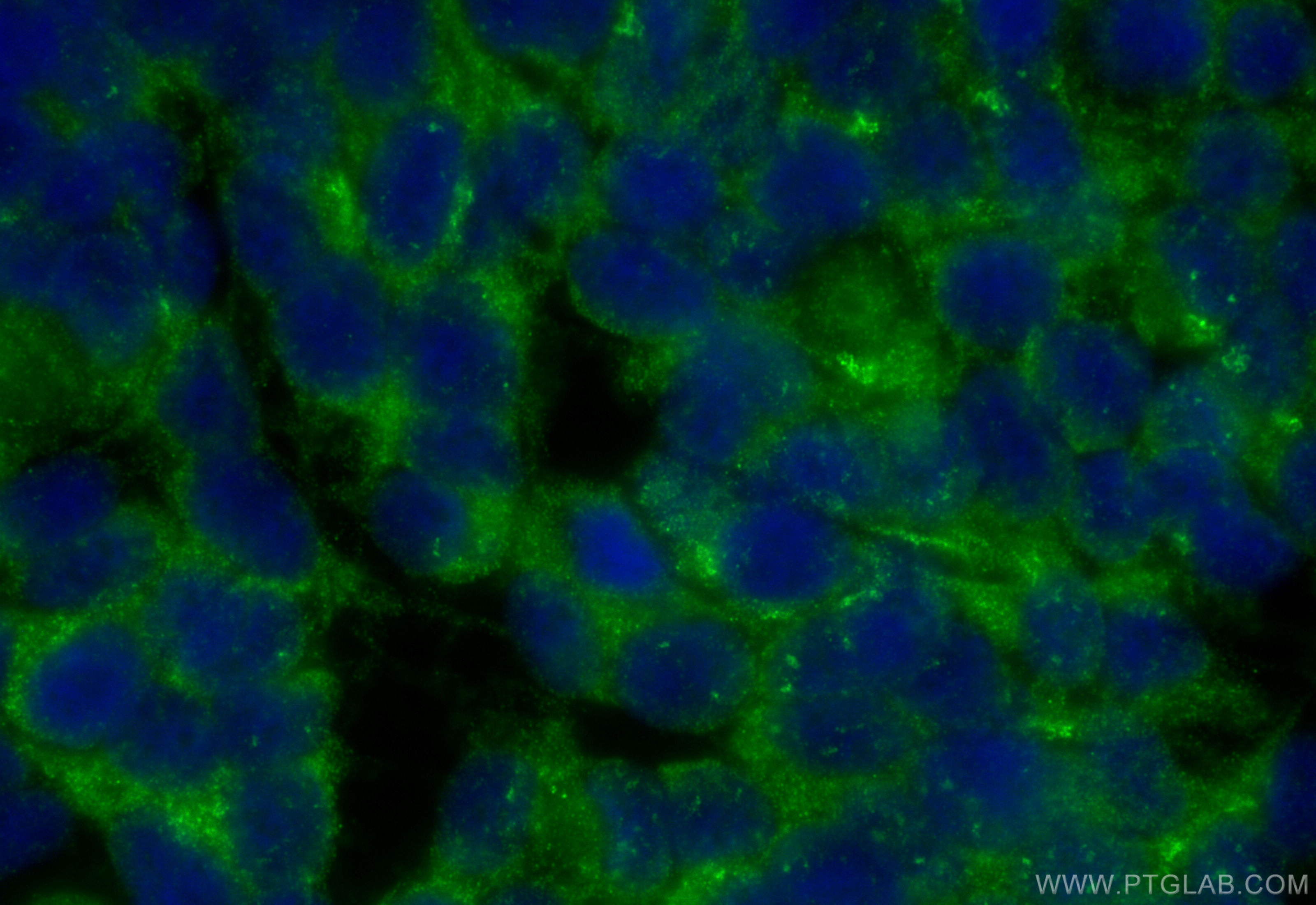 IF Staining of SH-SY5Y using 20356-1-AP