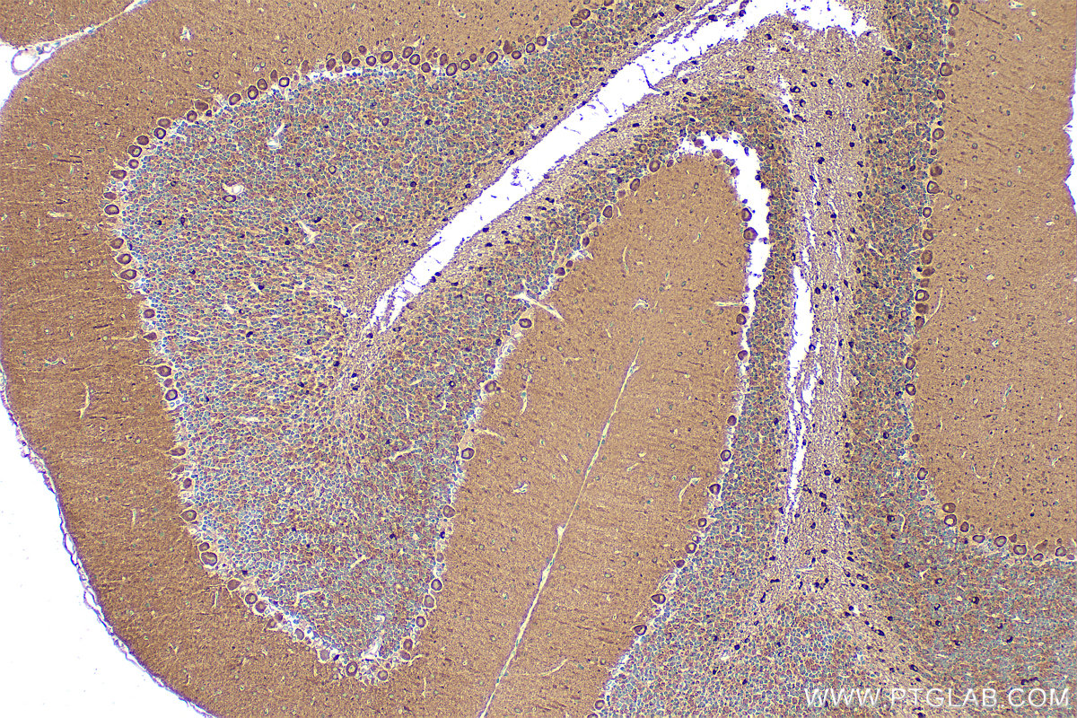 Immunohistochemical analysis of paraffin-embedded mouse cerebellum tissue slide using 20356-1-AP (TRIM2 antibody) at dilution of 1:400 (under 10x lens). Heat mediated antigen retrieval with Tris-EDTA buffer (pH 9.0). IHC staining of mouse cerebellum using 20356-1-AP