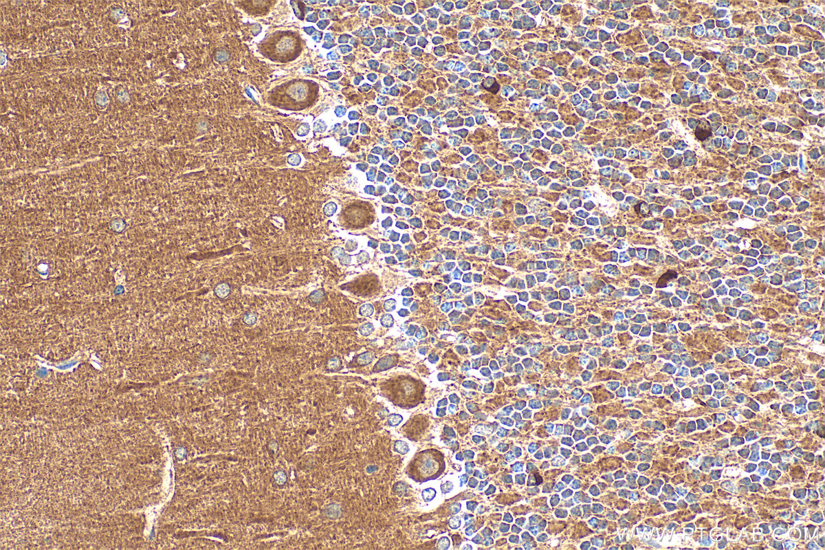 Immunohistochemical analysis of paraffin-embedded mouse cerebellum tissue slide using 20356-1-AP (TRIM2 antibody) at dilution of 1:400 (under 40x lens). Heat mediated antigen retrieval with Tris-EDTA buffer (pH 9.0). IHC staining of mouse cerebellum using 20356-1-AP