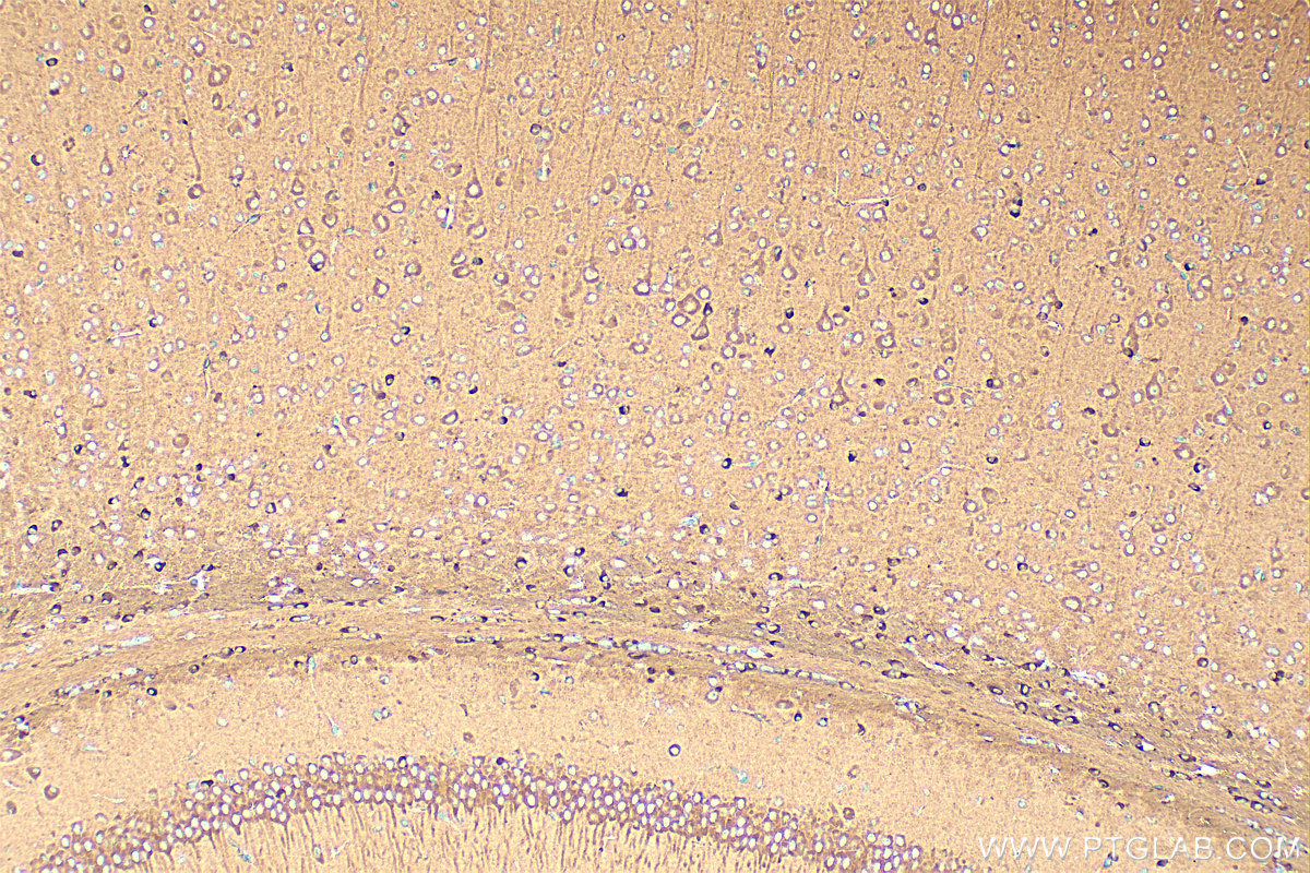 Immunohistochemical analysis of paraffin-embedded mouse brain tissue slide using 20356-1-AP (TRIM2 antibody) at dilution of 1:400 (under 10x lens). Heat mediated antigen retrieval with Tris-EDTA buffer (pH 9.0). IHC staining of mouse brain using 20356-1-AP