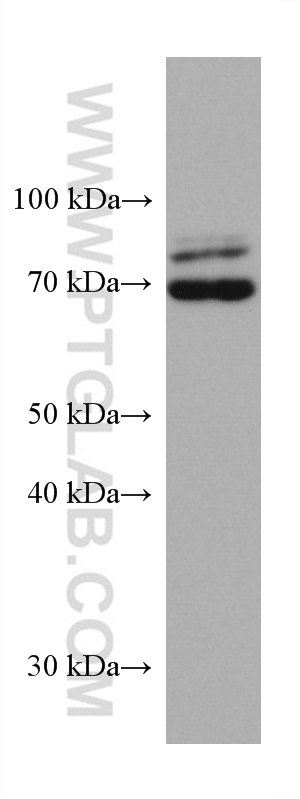 WB analysis of rat brain using 67342-1-Ig