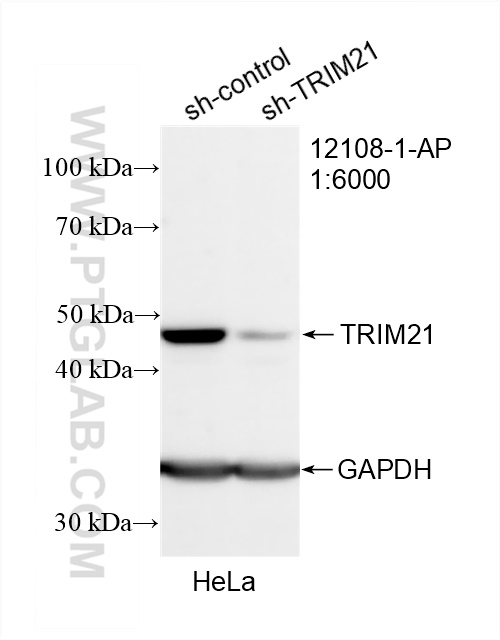 WB analysis of HeLa using 12108-1-AP