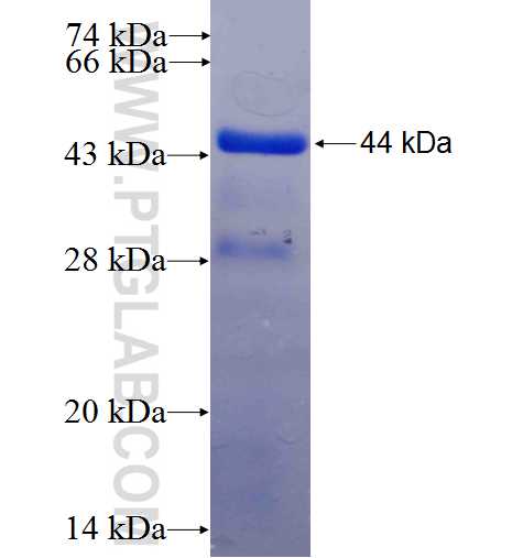 TRIM22 fusion protein Ag6938 SDS-PAGE TRIM22 fusion protein Ag6938 SDS-PAGE