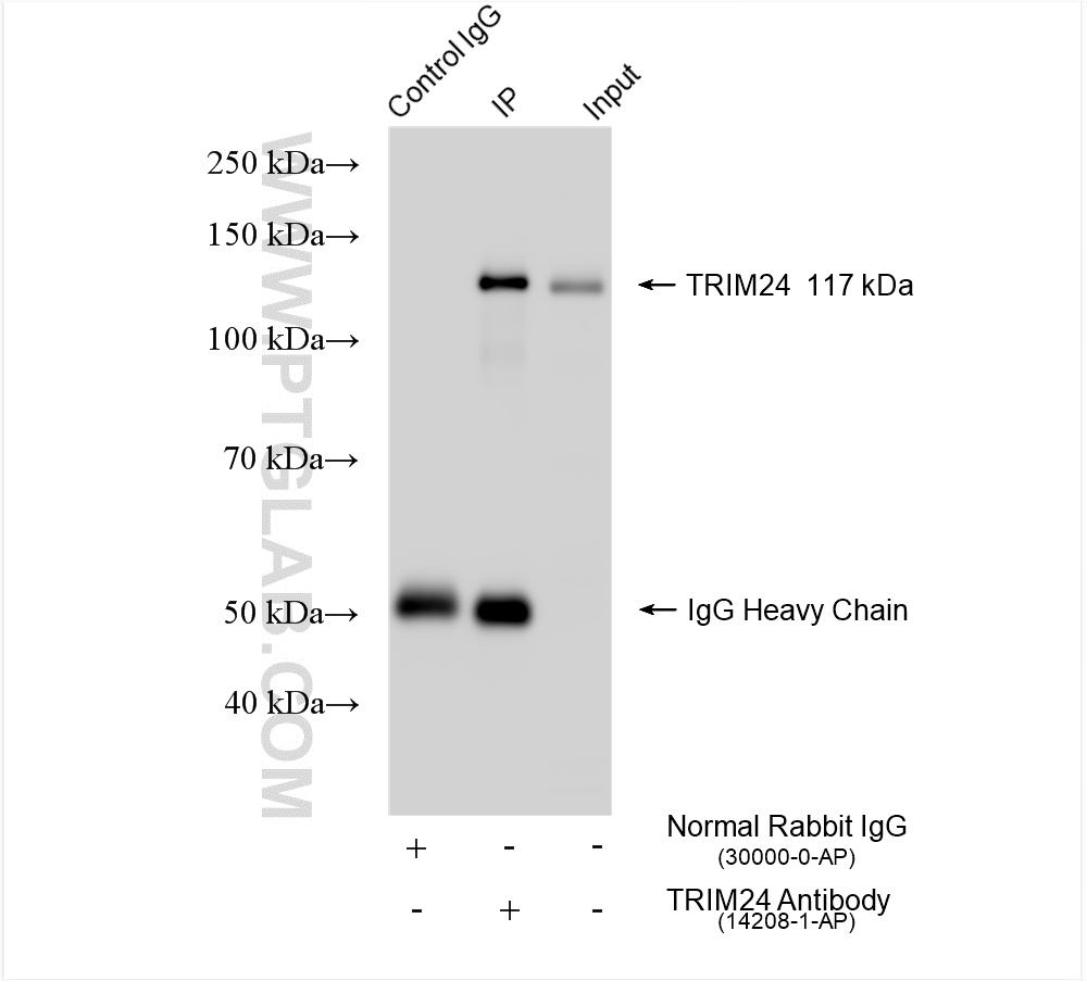 IP experiment of HeLa using 14208-1-AP
