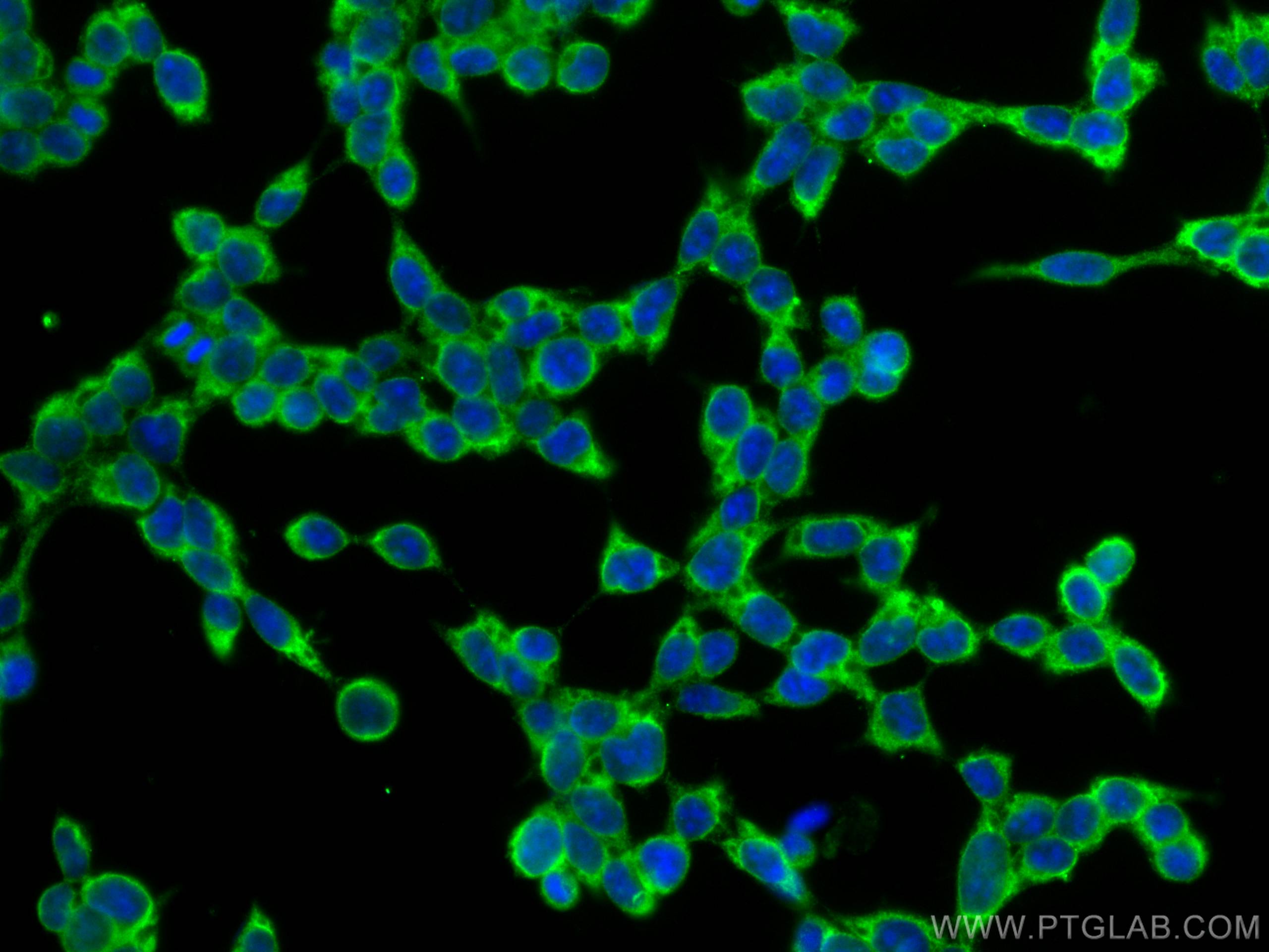 IF Staining of HEK-293T using 67314-1-Ig (same clone as 67314-1-PBS)