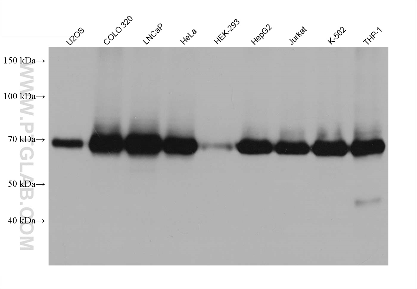 WB analysis using 67314-1-Ig