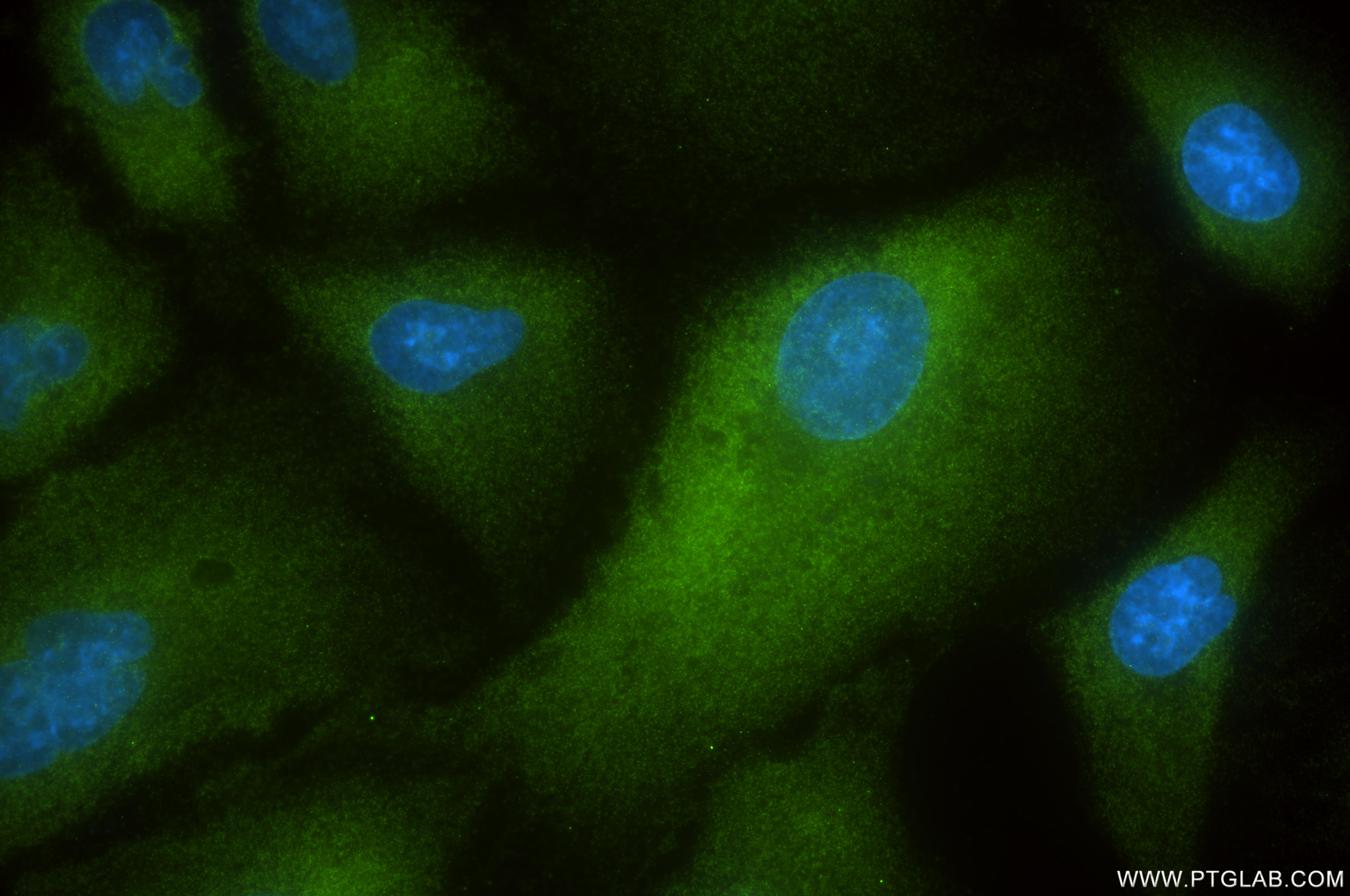 IF Staining of A549 using 85919-1-RR (same clone as 85919-1-PBS)