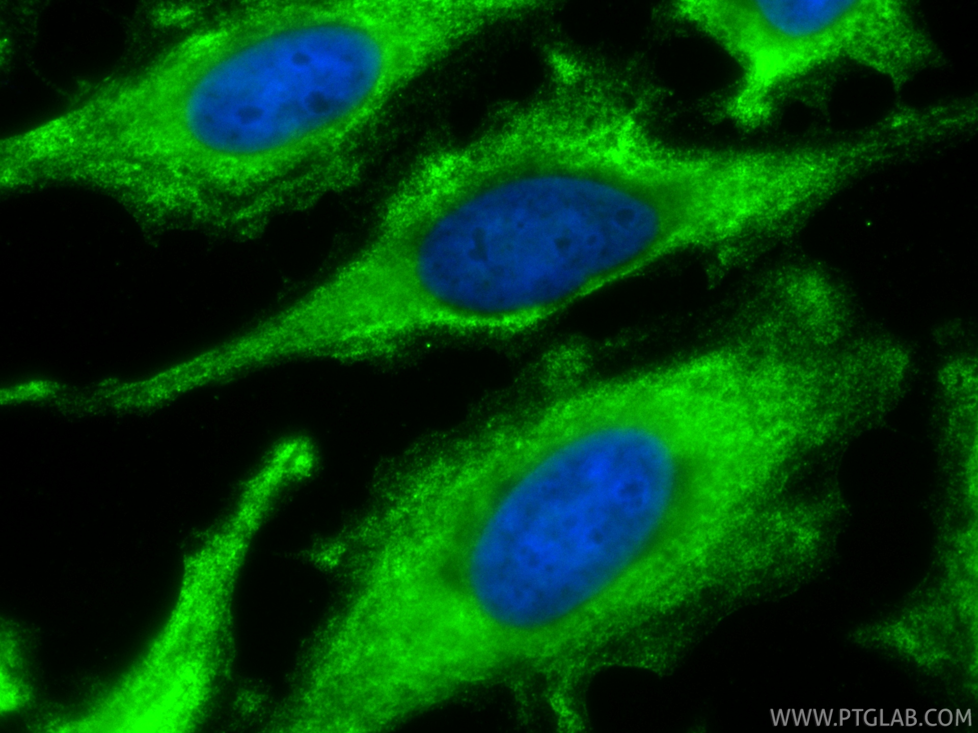 IF Staining of HeLa using CL488-67314 IF Staining of HeLa using CL488-67314