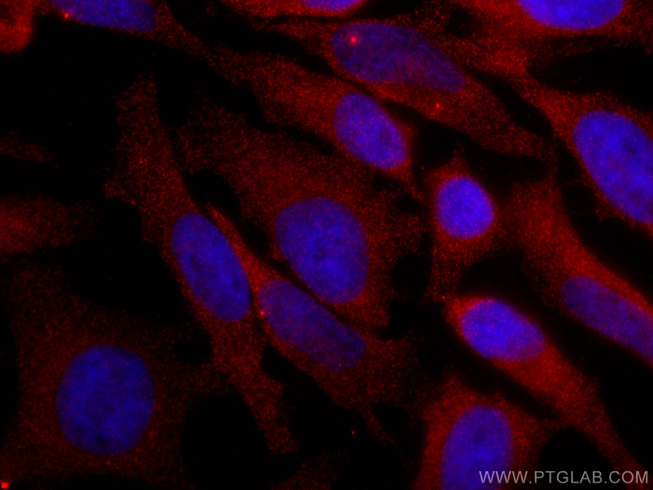 IF Staining of HeLa using CL594-67314