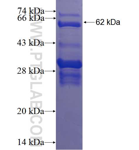 TRIM25 fusion protein Ag3241 SDS-PAGE