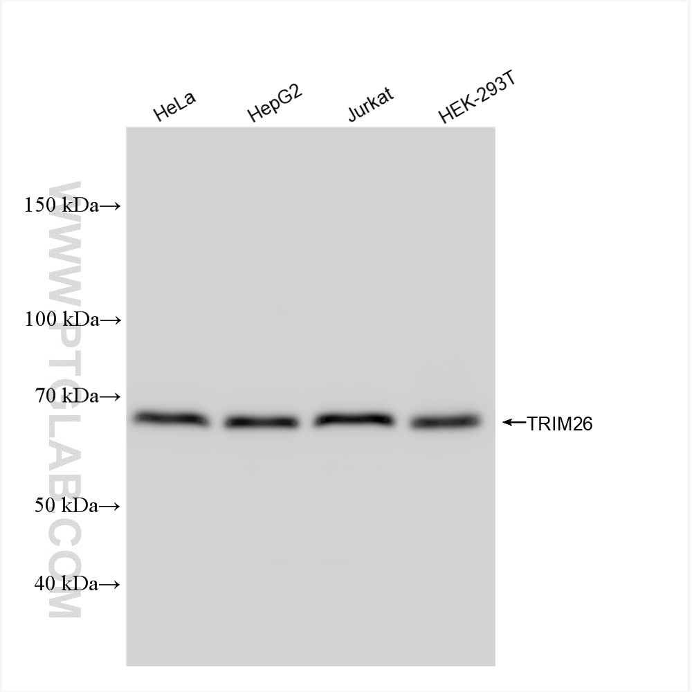 WB analysis using 84661-4-RR (same clone as 84661-4-PBS)