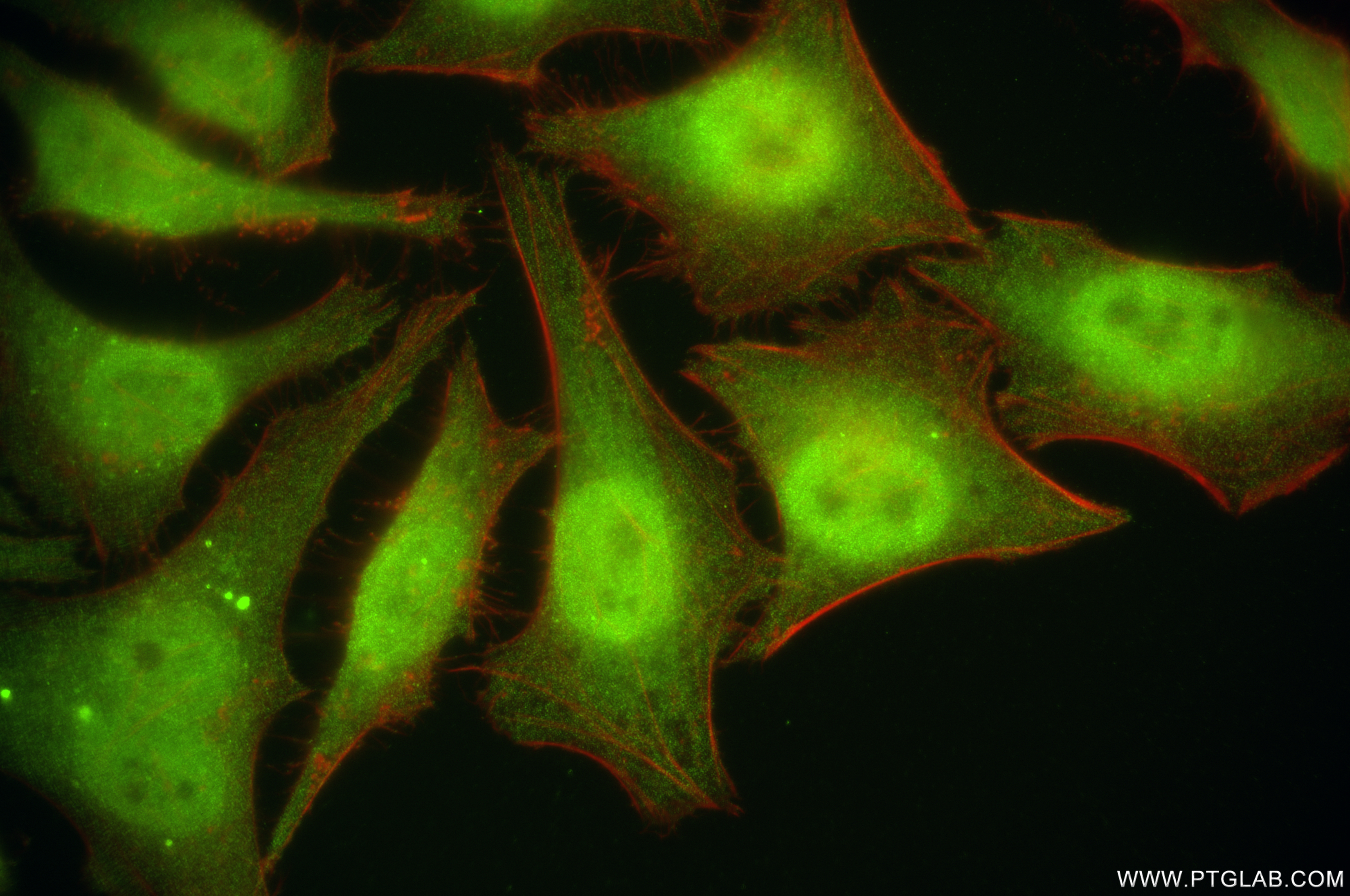 IF Staining of HeLa using 84927-6-RR