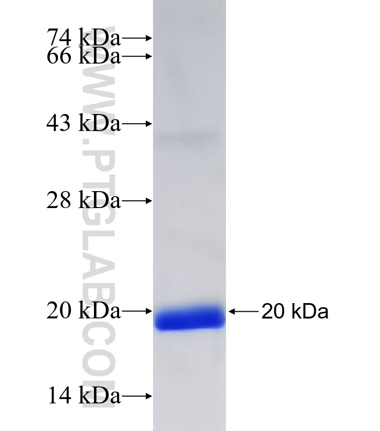 TRIM27 fusion protein Ag30592 SDS-PAGE TRIM27 fusion protein Ag30592 SDS-PAGE