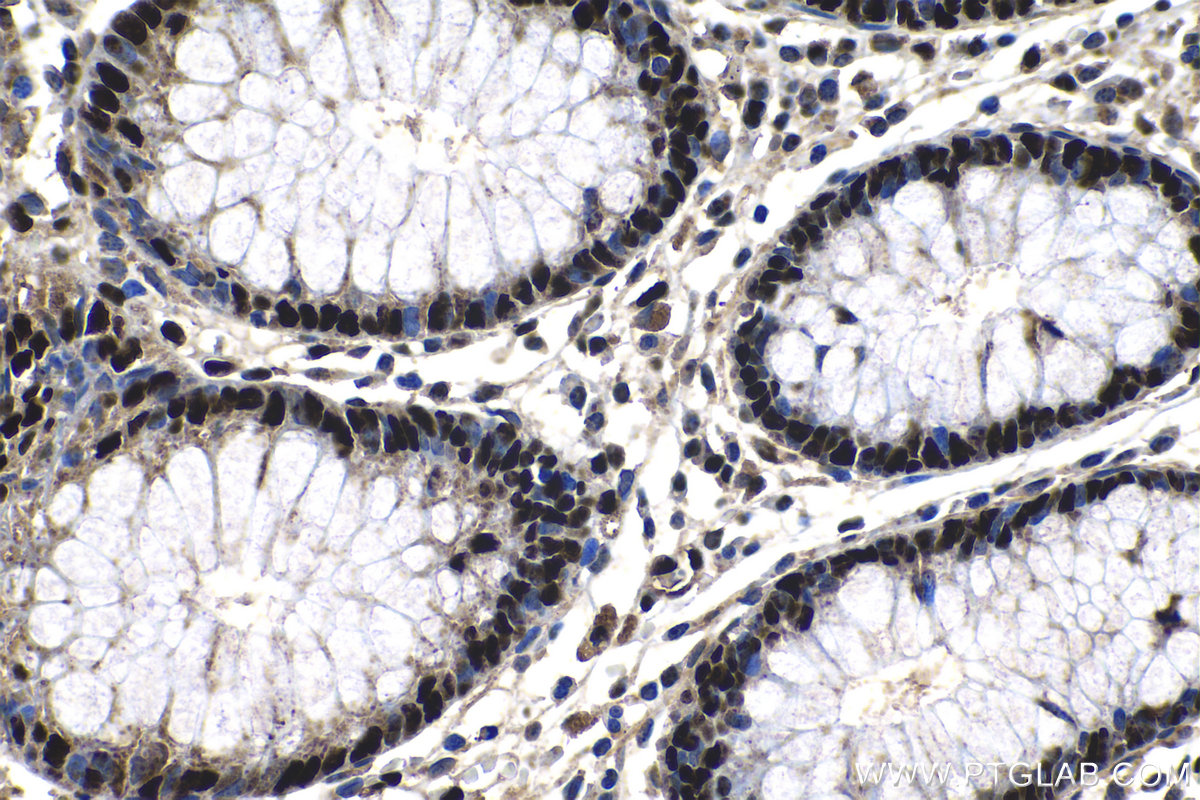 IHC staining of human colon using 15202-1-AP