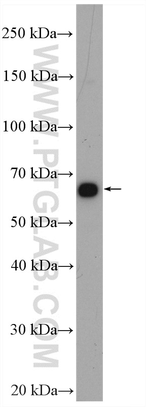WB analysis of BGC-823 using 17542-1-AP