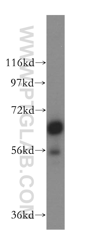 WB analysis of HeLa using 17542-1-AP