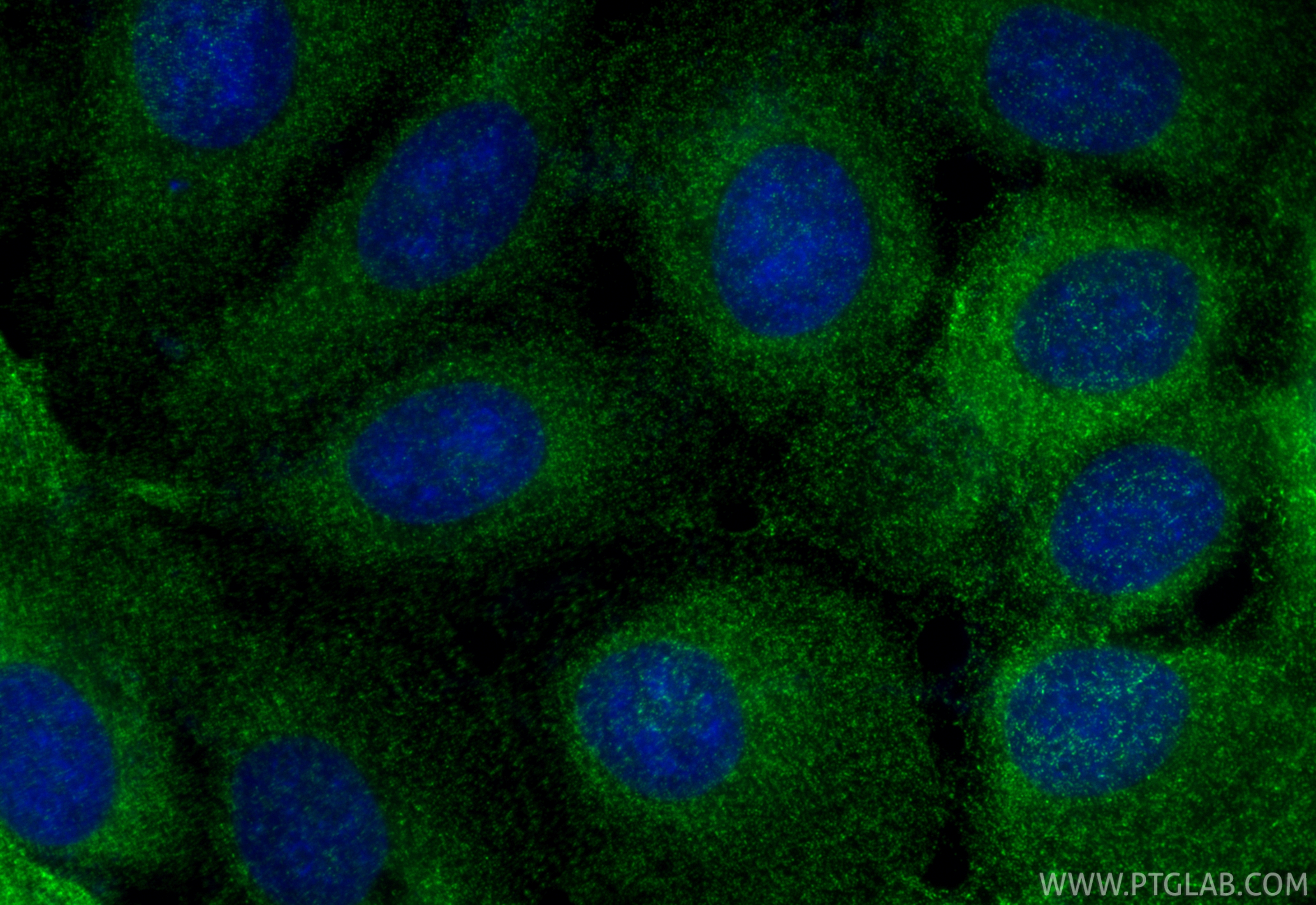 IF Staining of A431 using RMX00086