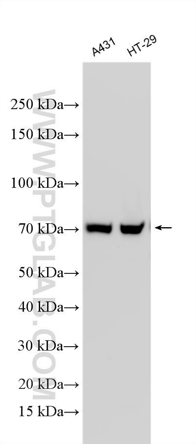 WB analysis using RMX00086