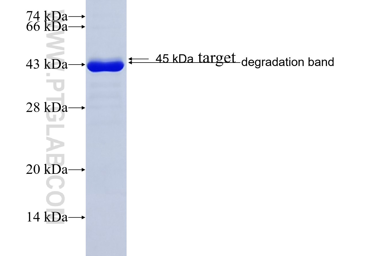 TRIM29 fusion protein Ag10611 SDS-PAGE TRIM29 fusion protein Ag10611 SDS-PAGE