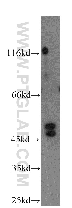 WB analysis of COLO 320 using 12543-1-AP