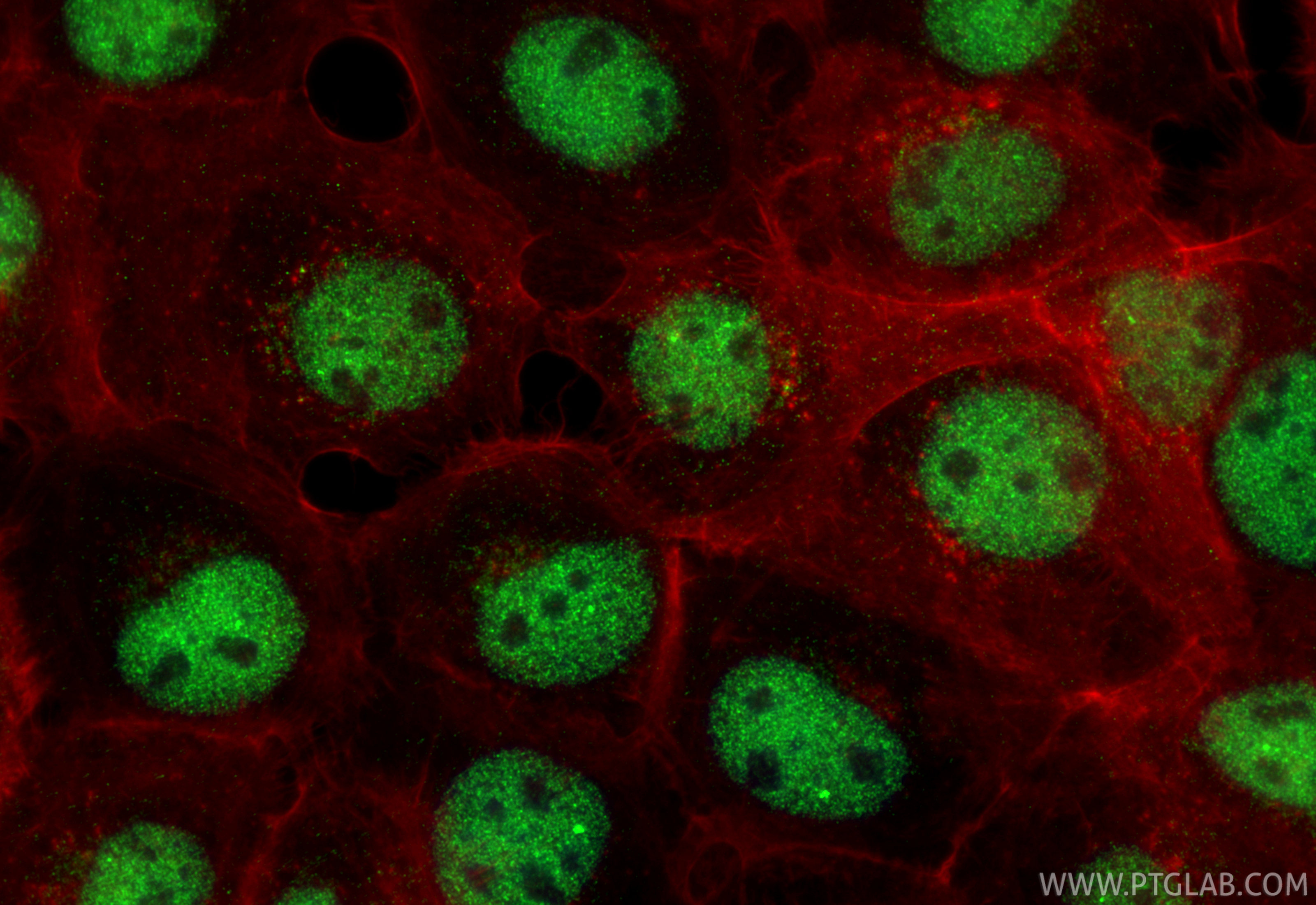 IF Staining of A431 using 85364-3-RR (same clone as 85364-3-PBS)