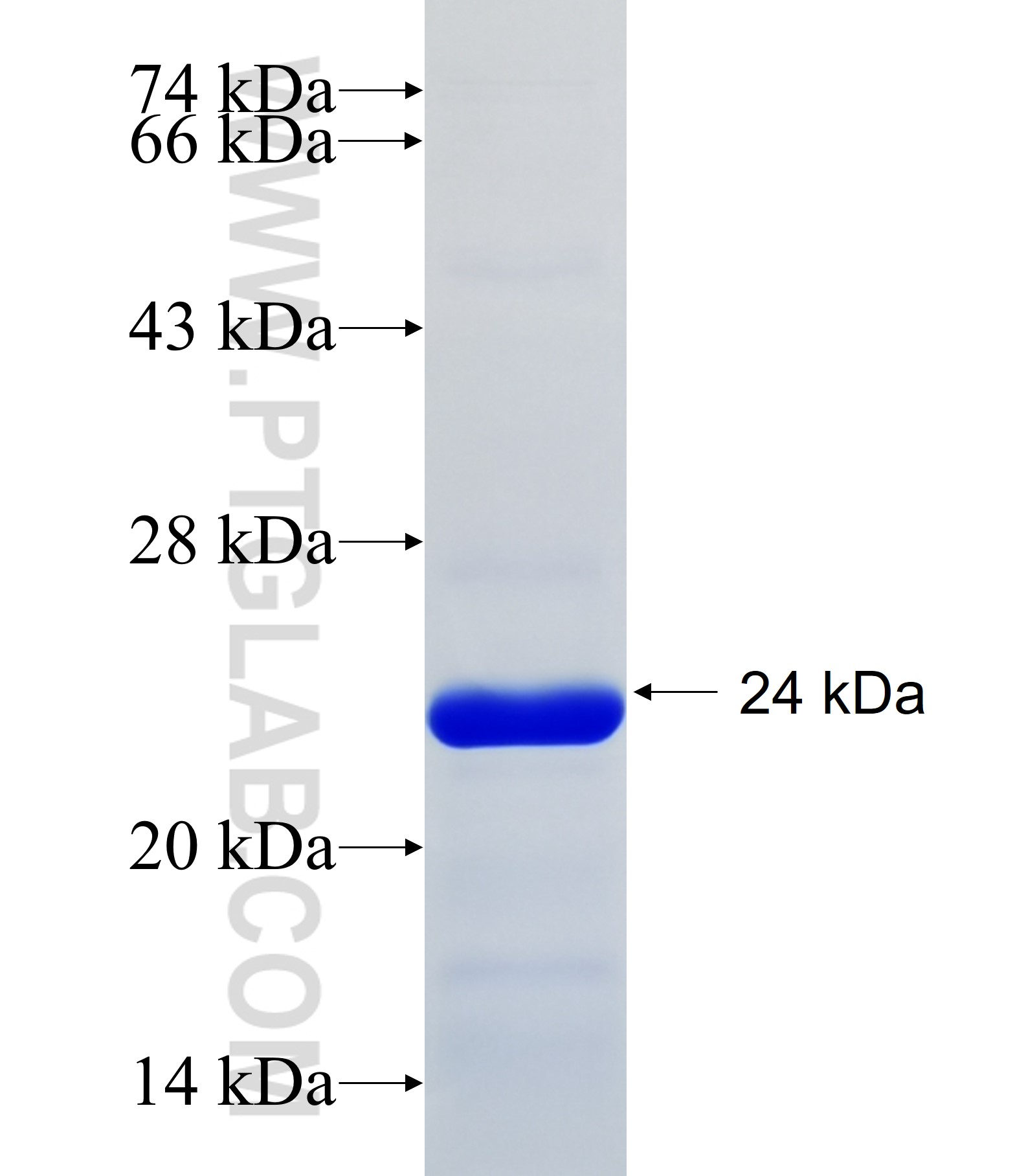 TRIM34 fusion protein Ag34465 SDS-PAGE