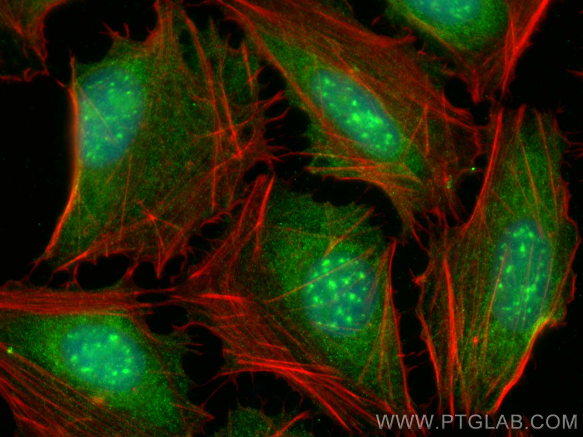 IF Staining of U2OS using 19806-1-AP