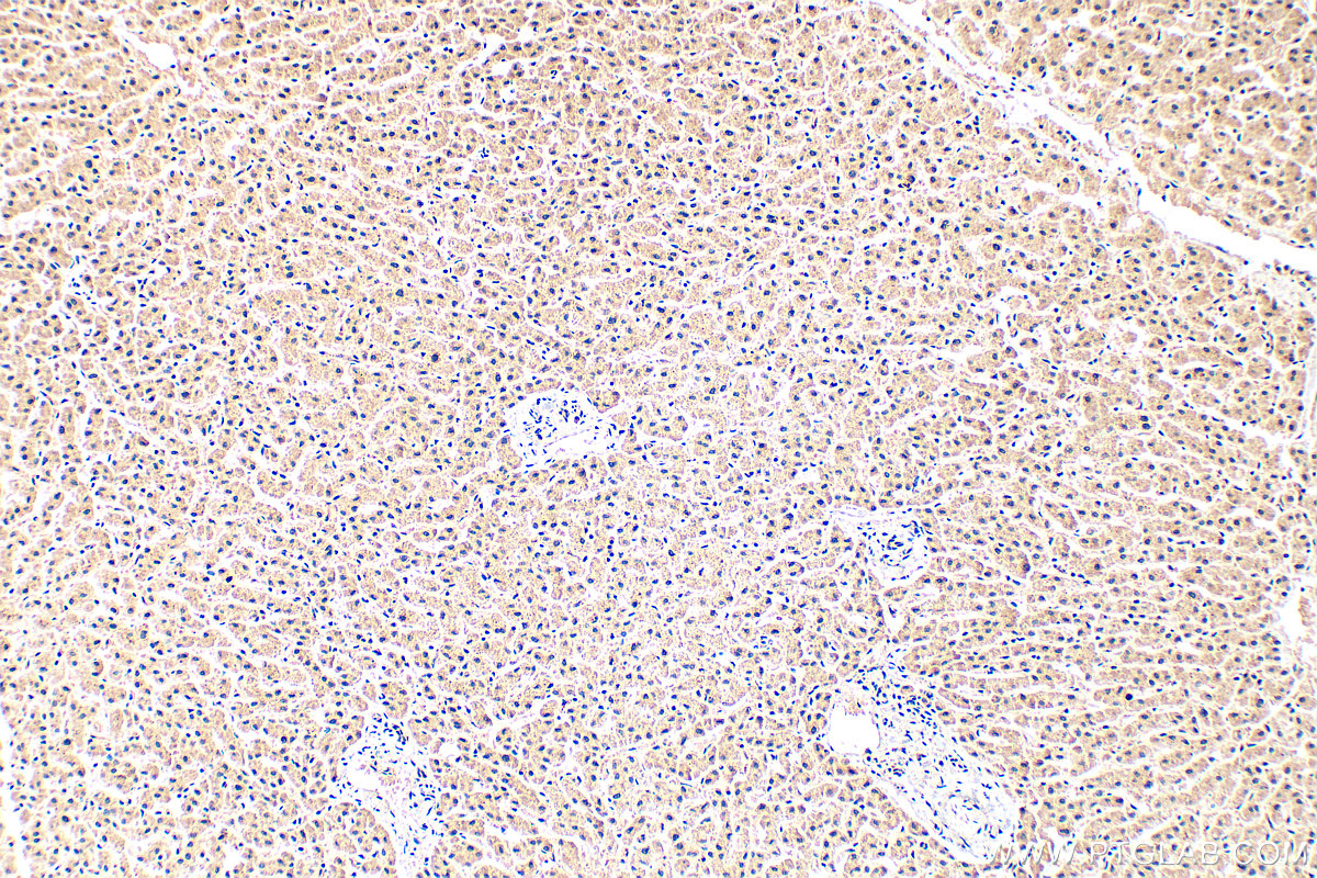 Immunohistochemical analysis of paraffin-embedded human liver tissue slide using 19806-1-AP (TRIM35 antibody) at dilution of 1:200 (under 10x lens). Heat mediated antigen retrieval with Tris-EDTA buffer (pH 9.0). IHC staining of human liver using 19806-1-AP