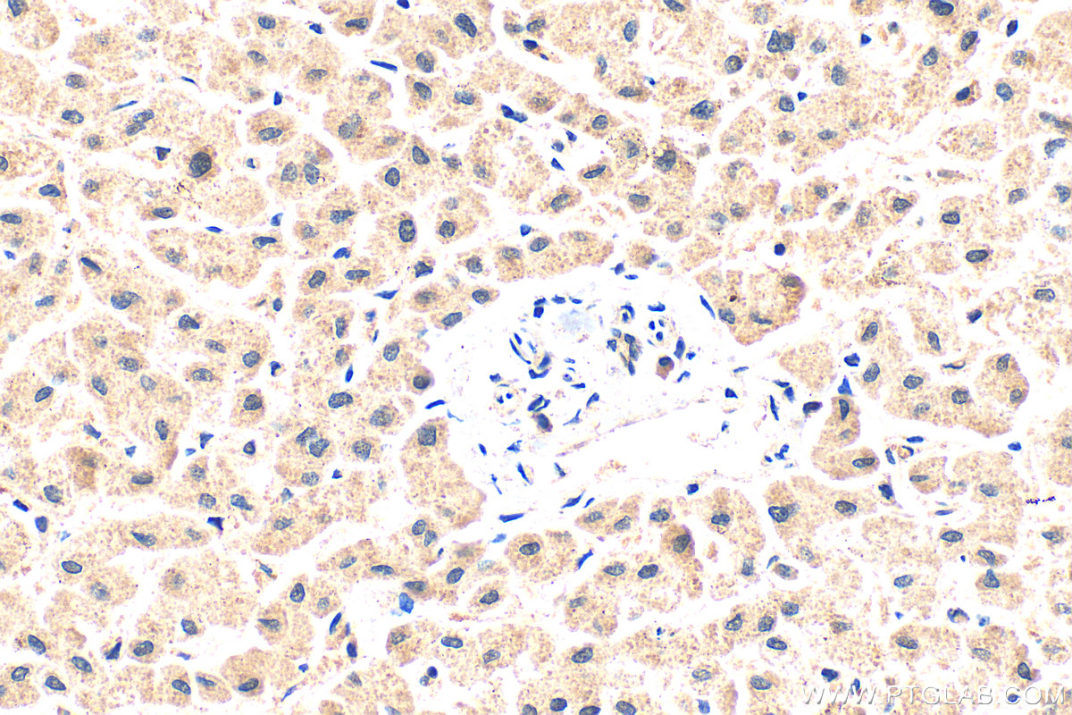 Immunohistochemical analysis of paraffin-embedded human liver tissue slide using 19806-1-AP (TRIM35 antibody) at dilution of 1:200 (under 40x lens). Heat mediated antigen retrieval with Tris-EDTA buffer (pH 9.0). IHC staining of human liver using 19806-1-AP