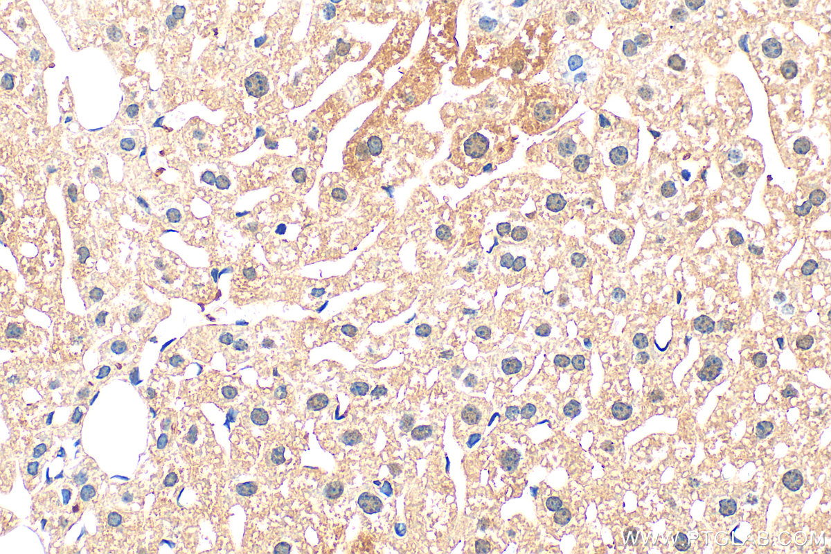 Immunohistochemical analysis of paraffin-embedded mouse liver tissue slide using 19806-1-AP (TRIM35 antibody) at dilution of 1:200 (under 40x lens). Heat mediated antigen retrieval with Tris-EDTA buffer (pH 9.0). IHC staining of mouse liver using 19806-1-AP
