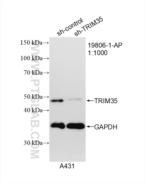 WB analysis of A431 using 19806-1-AP