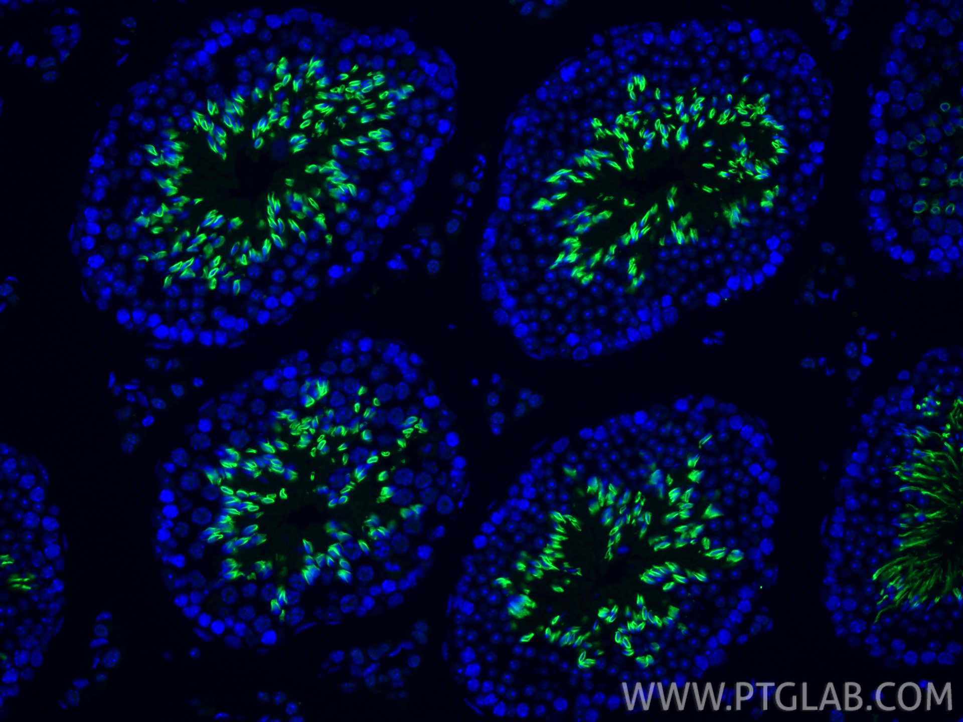 Immunofluorescent analysis of (4% PFA) fixed paraffin-embedded mouse testis tissue using TRIM36 antibody (25913-1-AP) at dilution of 1:200 and CoraLite®488-Conjugated Goat Anti-Rabbit IgG(H+L) (<a class='green' href='/productredirect?CatalogNo=SA00013-2' target='_blank'>SA00013-2</a>). Heat mediated antigen retrieval with Tris-EDTA buffer (pH 9.0). IF Staining of mouse testis using 25913-1-AP