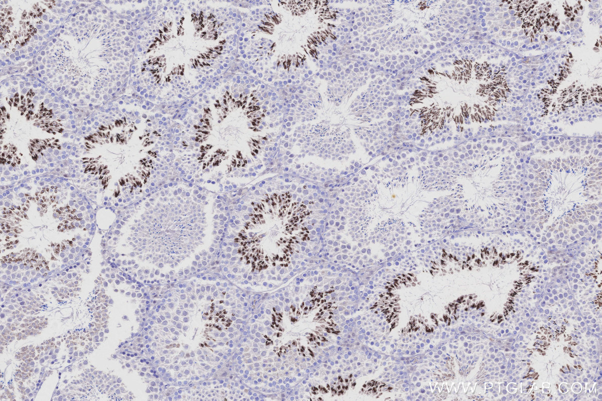 Immunohistochemical analysis of paraffin-embedded mouse testis tissue slide using 25913-1-AP (TRIM36 antibody) at dilution of 1:1000 (under 10x lens). Heat mediated antigen retrieval with Tris-EDTA buffer (pH 9.0). IHC staining of mouse testis using 25913-1-AP