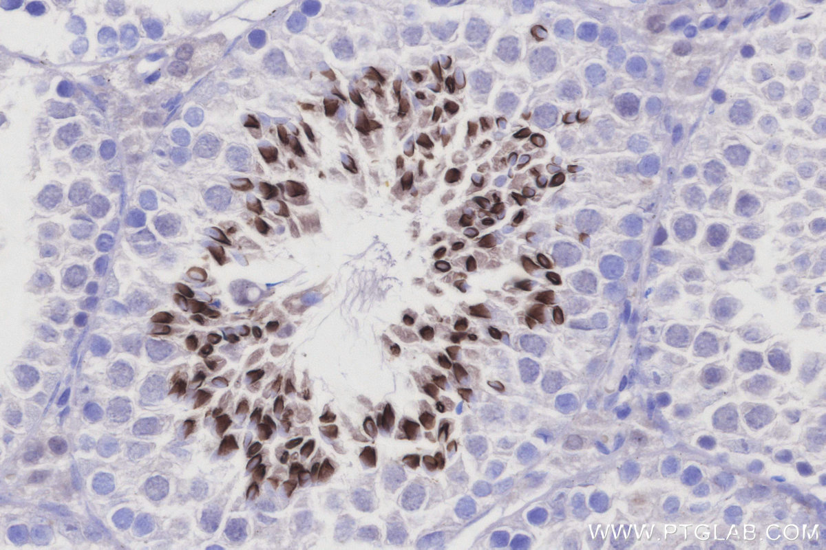 Immunohistochemical analysis of paraffin-embedded mouse testis tissue slide using 25913-1-AP (TRIM36 antibody) at dilution of 1:1000 (under 40x lens). Heat mediated antigen retrieval with Tris-EDTA buffer (pH 9.0). IHC staining of mouse testis using 25913-1-AP