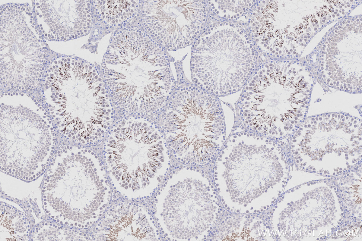 Immunohistochemical analysis of paraffin-embedded rat testis tissue slide using 25913-1-AP (TRIM36 antibody) at dilution of 1:1000 (under 10x lens). Heat mediated antigen retrieval with Tris-EDTA buffer (pH 9.0). IHC staining of rat testis using 25913-1-AP