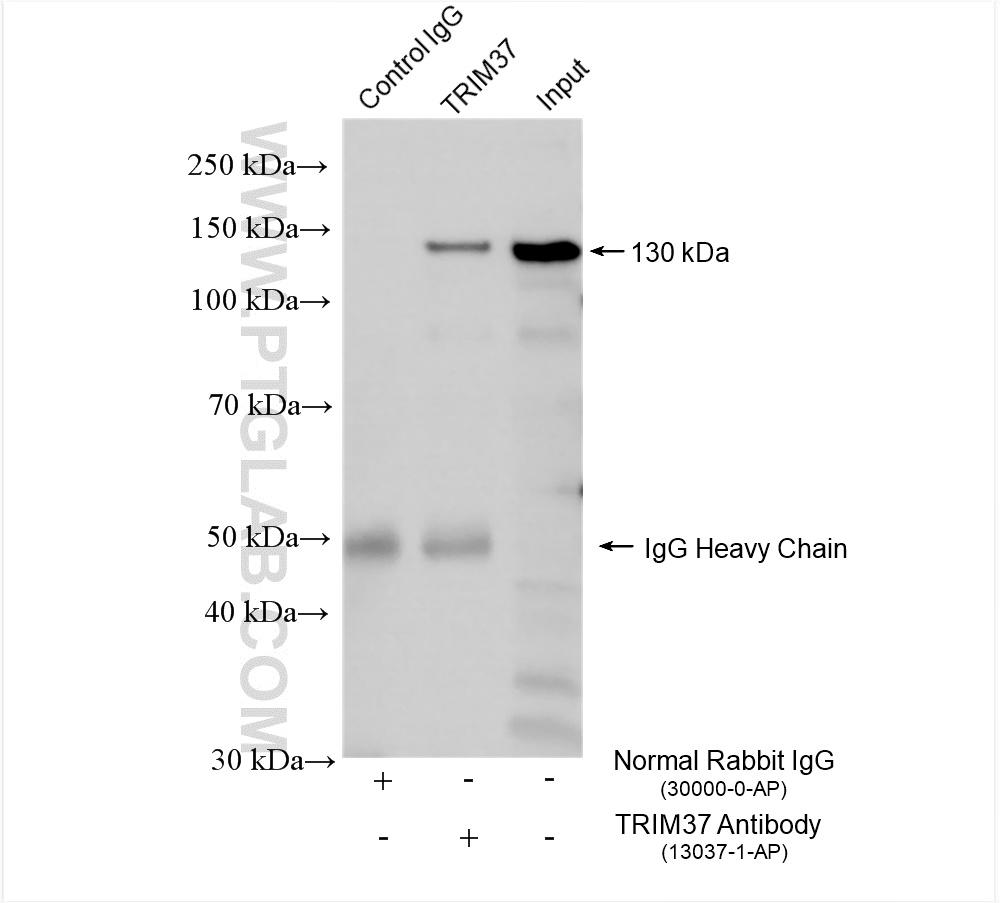 IP experiment of mouse brain using 13037-1-AP