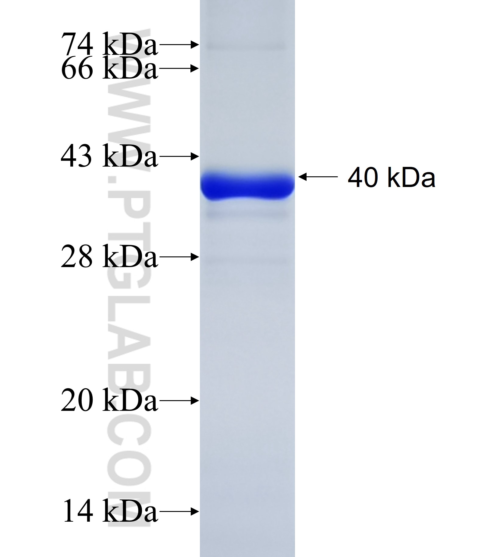 TRIM37 fusion protein Ag34699 SDS-PAGE TRIM37 fusion protein Ag34699 SDS-PAGE