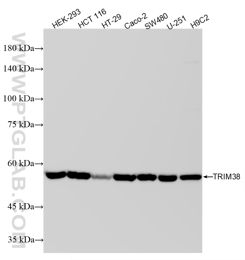 Various lysates were subjected to SDS PAGE followed by western blot with <a class='green' href='/productredirect?CatalogNo=87196-1-RR' target='_blank'>87196-1-RR</a> (TRIM38 antibody) at dilution of 1:10000 incubated at room temperature for 1.5 hours. This data was developed using the same antibody clone with 87196-1-PBS in a different storage buffer formulation. WB analysis using 87196-1-RR (same clone as 87196-1-PBS)
