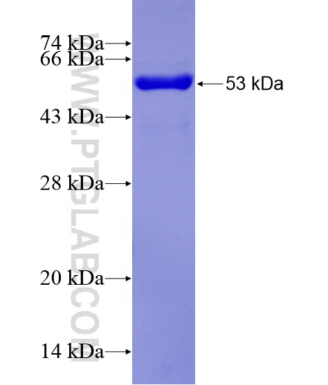TRIM38 fusion protein Ag29033 SDS-PAGE TRIM38 fusion protein Ag29033 SDS-PAGE