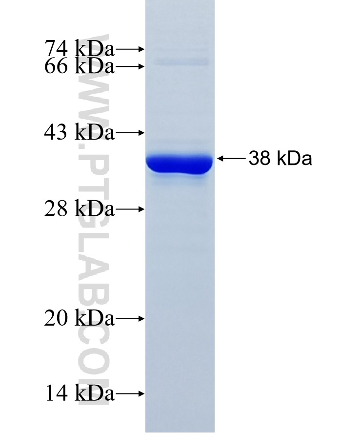 TRIM4 fusion protein Ag22112 SDS-PAGE